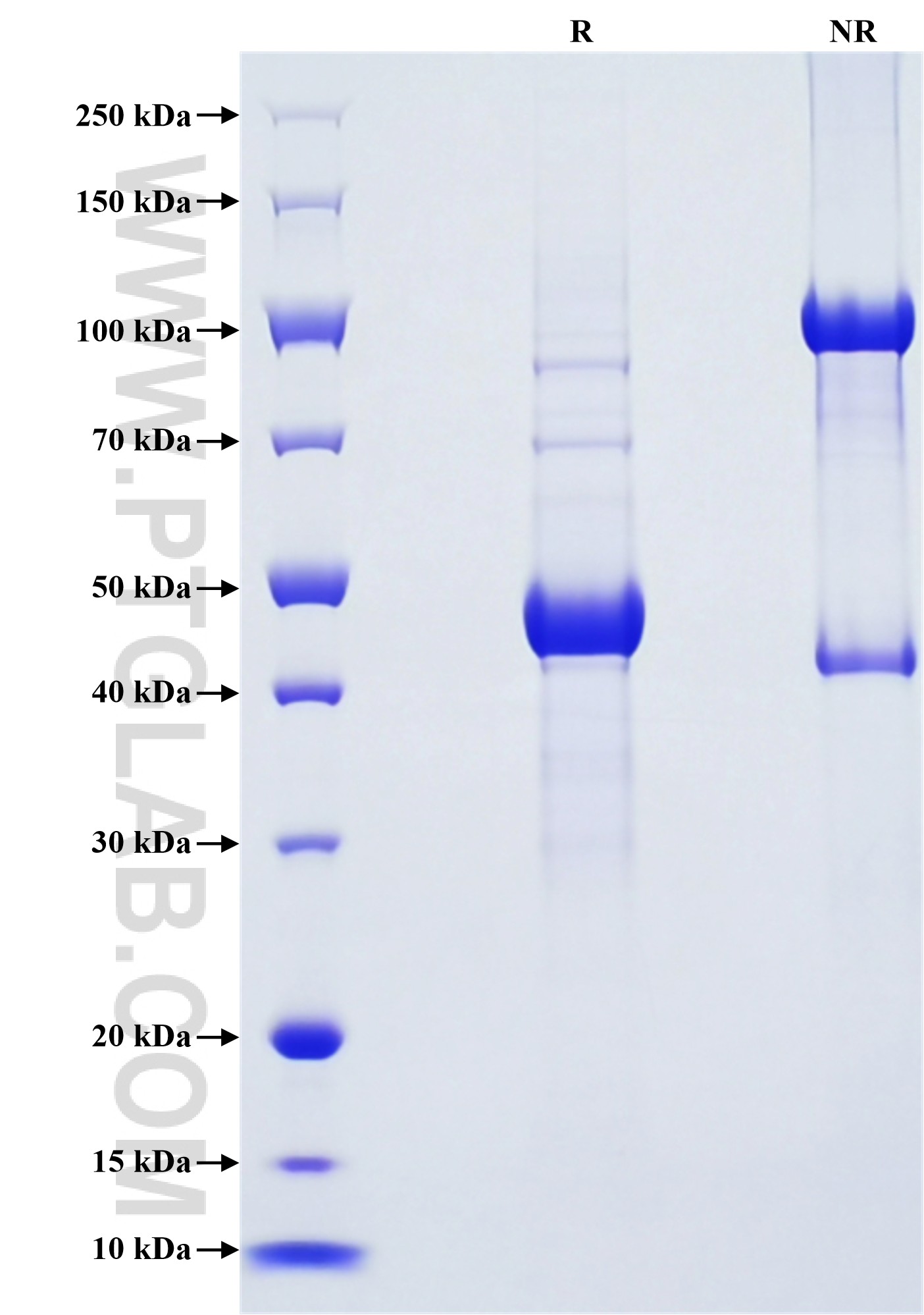 Purity of Recombinant Human CRH was determined by SDS-PAGE. The protein was resolved in an SDS-PAGE in reducing (R) and non-reducing (NR) conditions and stained using Coomassie blue. Purity of Recombinant Human CRH was determined by SDS-PAGE. The protein was resolved in an SDS-PAGE in reducing (R) and non-reducing (NR) conditions and stained using Coomassie blue.