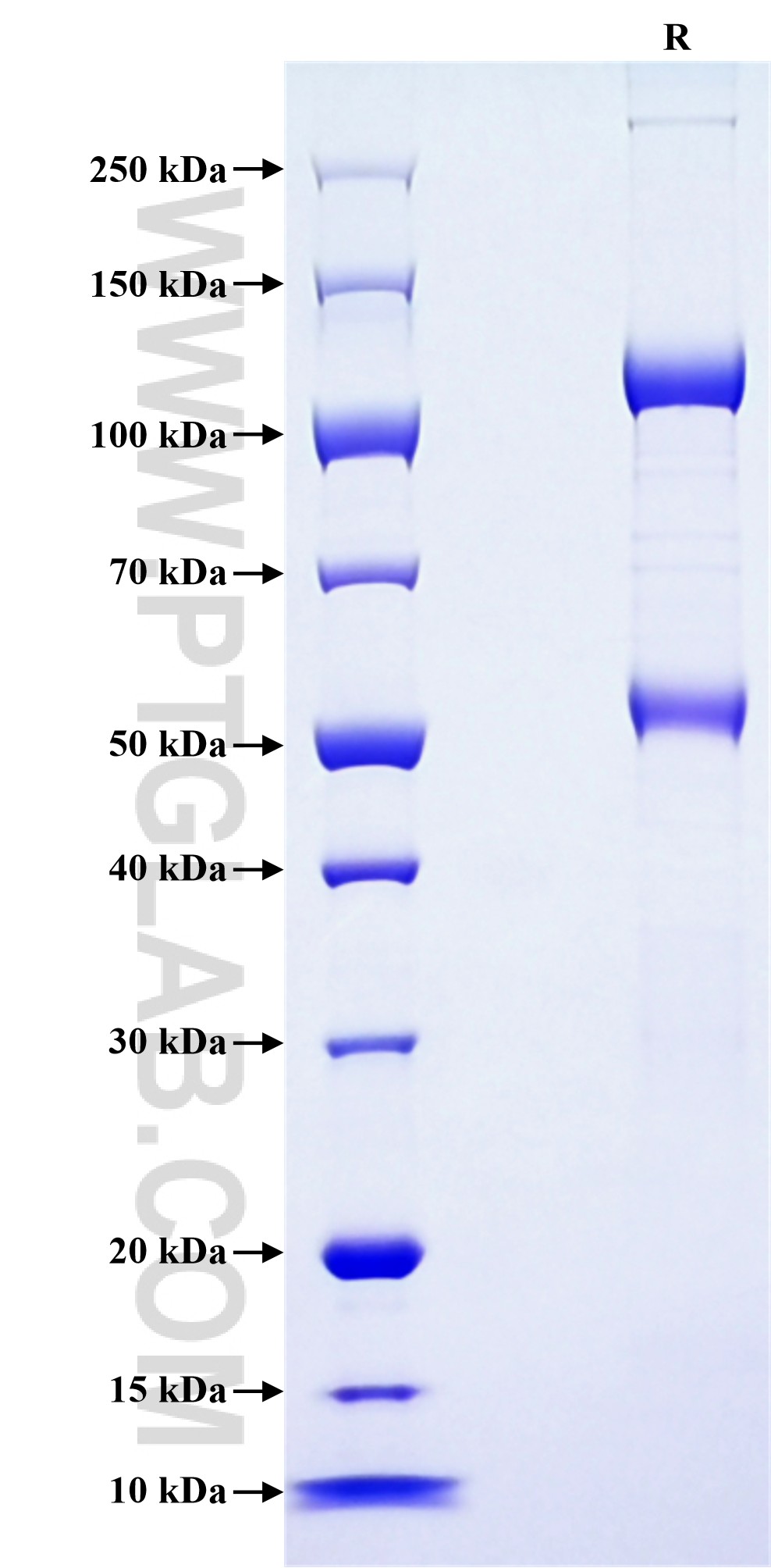 Purity of Recombinant Human SEMA3C was determined by SDS-PAGE. The protein was resolved in an SDS-PAGE in reducing (R) conditions and stained using Coomassie blue. Purity of Recombinant Human SEMA3C was determined by SDS-PAGE. The protein was resolved in an SDS-PAGE in reducing (R) conditions and stained using Coomassie blue.