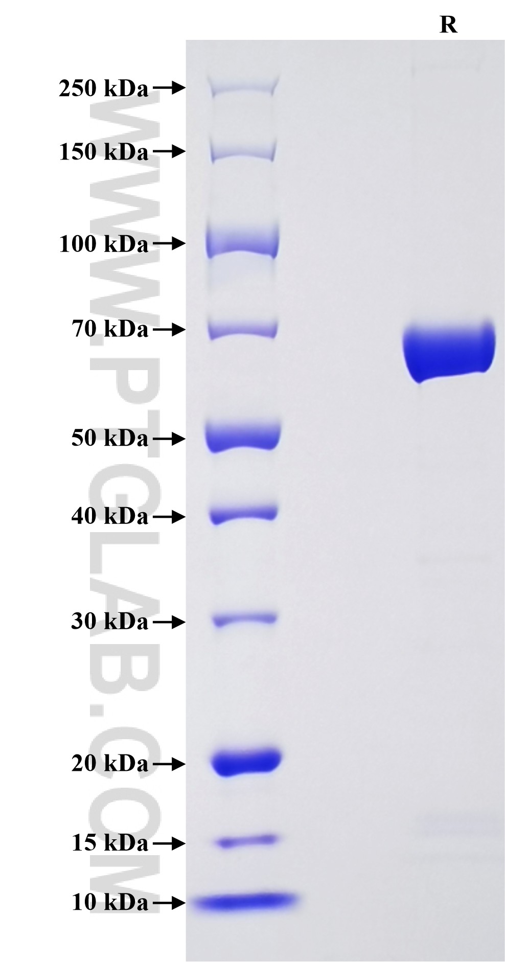 Purity of Recombinant Human CHI3L1 was determined by SDS-PAGE. The protein was resolved in an SDS-PAGE in reducing (R) conditions and stained using Coomassie blue.