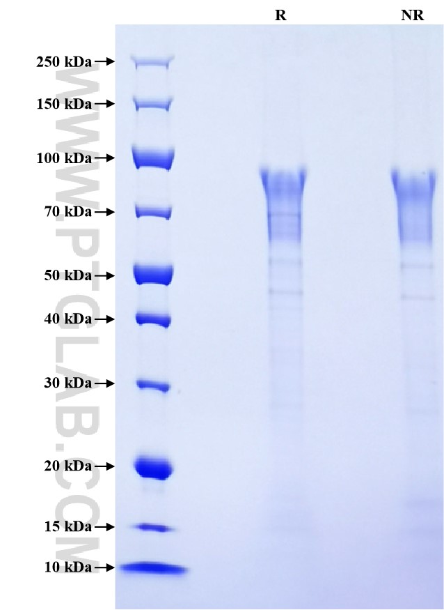 Purity of Recombinant Human IBSP was determined by SDS-PAGE. The protein was resolved in an SDS-PAGE in reducing (R) and non-reducing (NR) conditions and stained using Coomassie blue. Purity of Recombinant Human IBSP was determined by SDS-PAGE. The protein was resolved in an SDS-PAGE in reducing (R) and non-reducing (NR) conditions and stained using Coomassie blue.