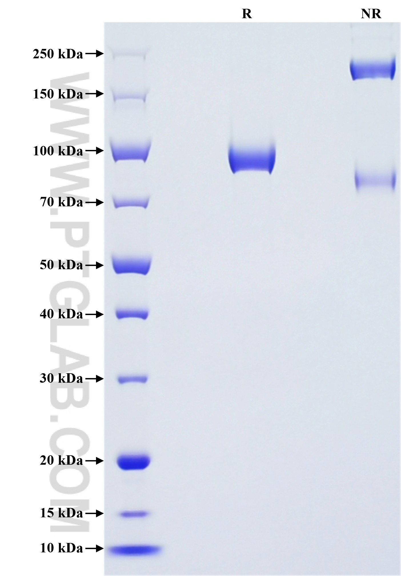 Purity of Recombinant Mouse Siglec1 was determined by SDS-PAGE. The protein was resolved in an SDS-PAGE in reducing (R) and non-reducing (NR) conditions and stained using Coomassie blue.