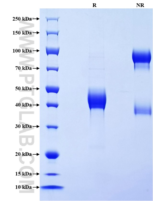 Purity of Recombinant Human CD247 was determined by SDS-PAGE. The protein was resolved in an SDS-PAGE in reducing (R) and non-reducing (NR) conditions and stained using Coomassie blue. Purity of Recombinant Human CD247 was determined by SDS-PAGE. The protein was resolved in an SDS-PAGE in reducing (R) and non-reducing (NR) conditions and stained using Coomassie blue.