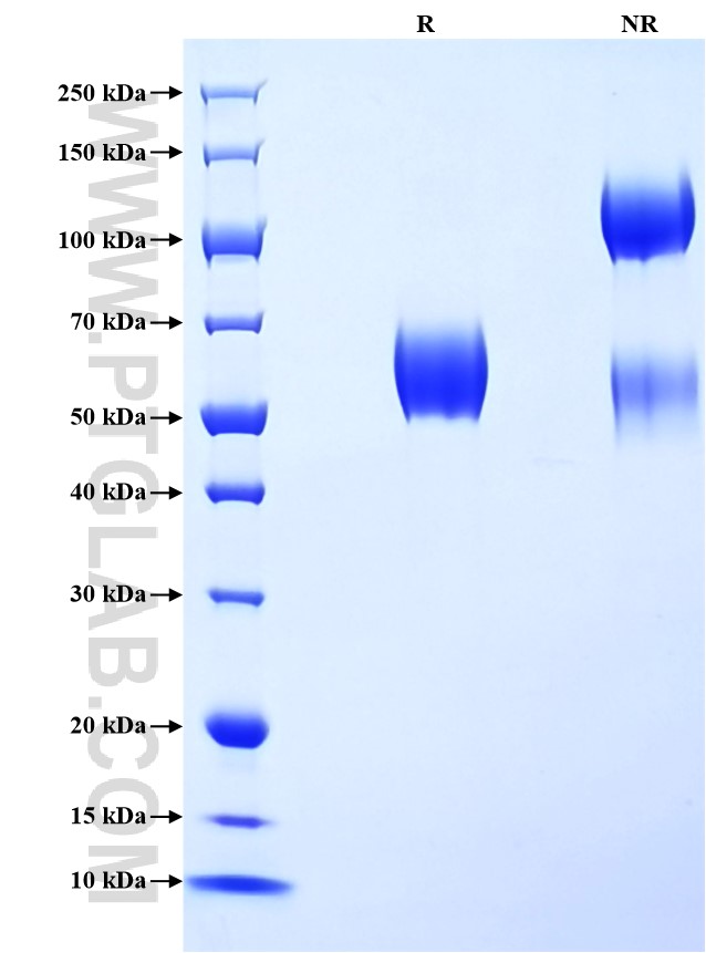 Purity of Recombinant Human CLEC5A was determined by SDS-PAGE. The protein was resolved in an SDS-PAGE in reducing (R) and non-reducing (NR) conditions and stained using Coomassie blue. Purity of Recombinant Human CLEC5A was determined by SDS-PAGE. The protein was resolved in an SDS-PAGE in reducing (R) and non-reducing (NR) conditions and stained using Coomassie blue.