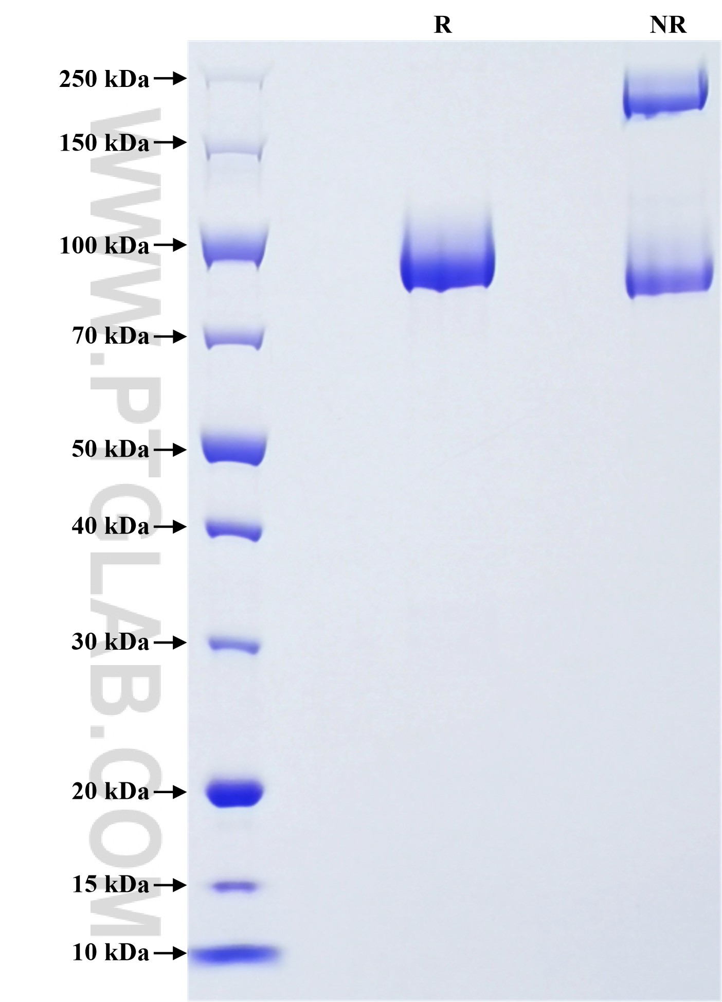 Purity of Recombinant Human ALCAM was determined by SDS-PAGE. The protein was resolved in an SDS-PAGE in reducing (R) and non-reducing (NR) conditions and stained using Coomassie blue.