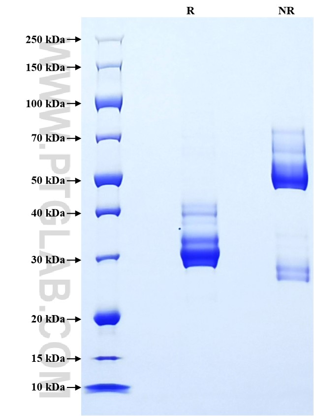Purity of Recombinant Mouse CXCL10 was determined by SDS-PAGE. The protein was resolved in an SDS-PAGE in reducing (R) and non-reducing (NR) conditions and stained using Coomassie blue.