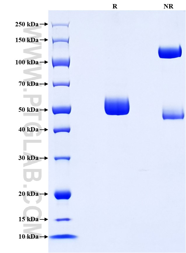 Purity of Recombinant Mouse IL-27 p28 was determined by SDS-PAGE. The protein was resolved in an SDS-PAGE in reducing (R) and non-reducing (NR) conditions and stained using Coomassie blue. Purity of Recombinant Mouse IL-27 p28 was determined by SDS-PAGE. The protein was resolved in an SDS-PAGE in reducing (R) and non-reducing (NR) conditions and stained using Coomassie blue.