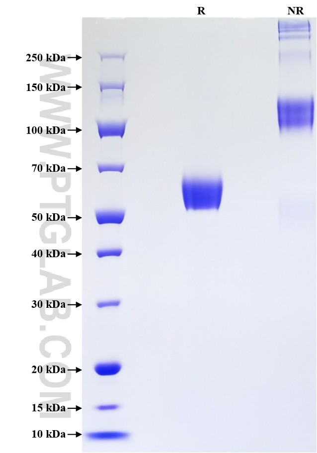 Purity of Recombinant Human LTBR was determined by SDS-PAGE. The protein was resolved in an SDS-PAGE in reducing (R) and non-reducing (NR) conditions and stained using Coomassie blue. Purity of Recombinant Human LTBR was determined by SDS-PAGE. The protein was resolved in an SDS-PAGE in reducing (R) and non-reducing (NR) conditions and stained using Coomassie blue.