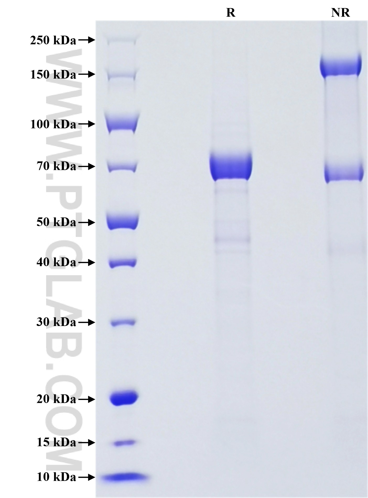 Purity of Recombinant Human P-cadherin was determined by SDS-PAGE. The protein was resolved in an SDS-PAGE in reducing (R) and non-reducing (NR) conditions and stained using Coomassie blue.