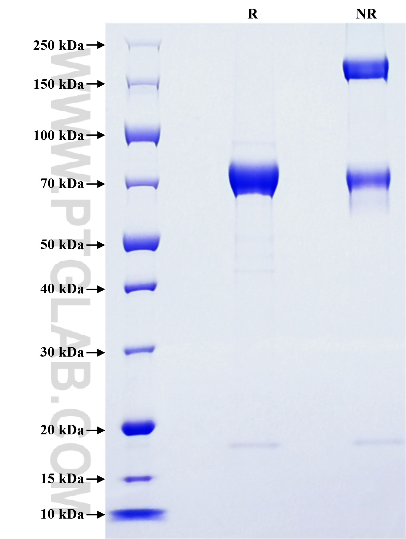 Purity of Recombinant Mouse ST6GAL1 was determined by SDS-PAGE. The protein was resolved in an SDS-PAGE in reducing (R) and non-reducing (NR) conditions and stained using Coomassie blue.