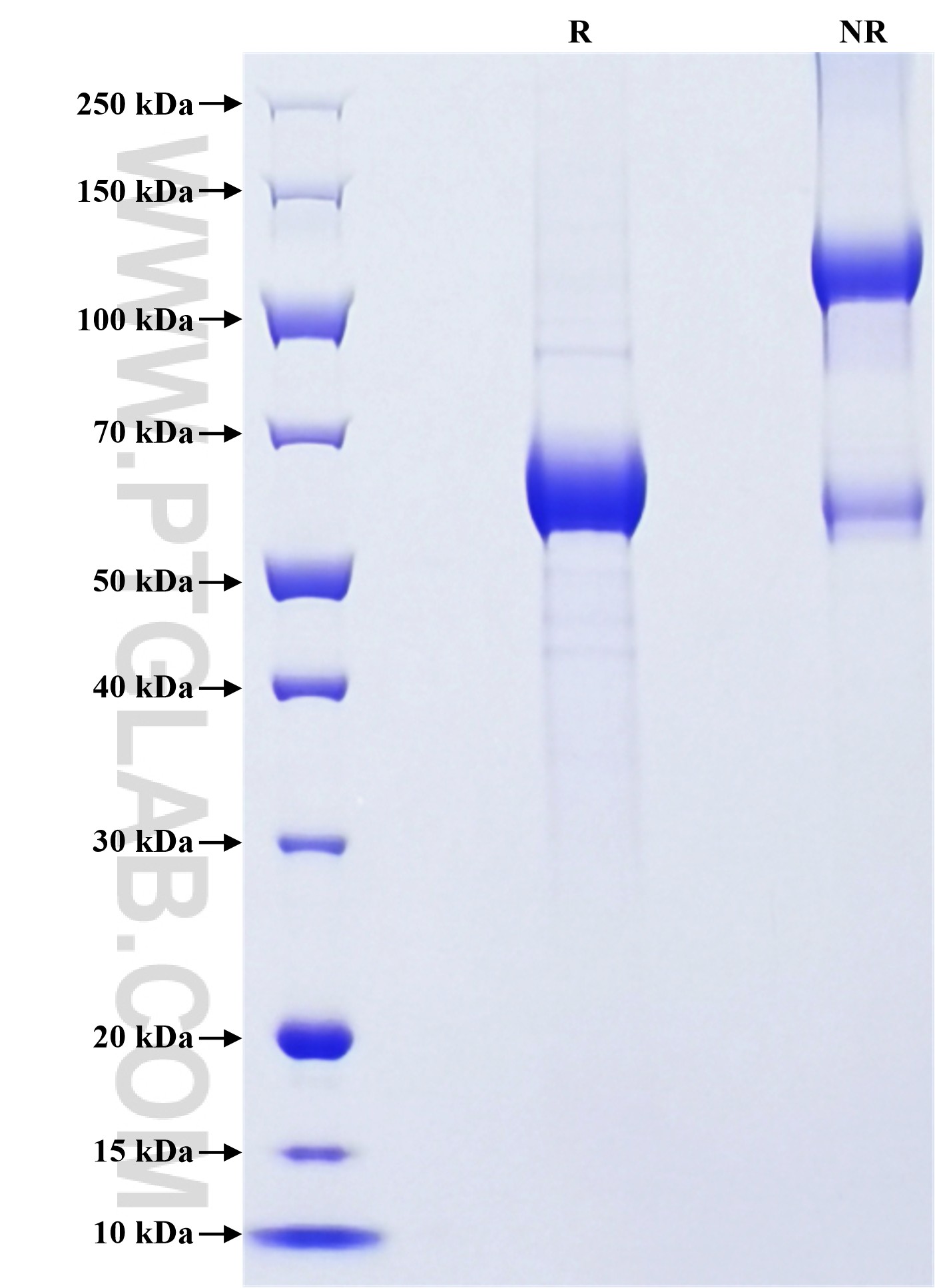 Purity of Recombinant Human ANGPTL4 was determined by SDS-PAGE. The protein was resolved in an SDS-PAGE in reducing (R) and non-reducing (NR) conditions and stained using Coomassie blue.