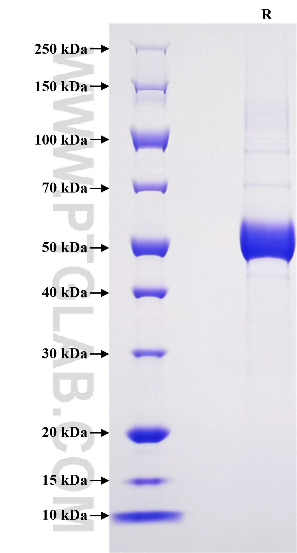 Purity of Recombinant Human IFNW1 was determined by SDS-PAGE. The protein was resolved in an SDS-PAGE in reducing (R) conditions and stained using Coomassie blue. Purity of Recombinant Human IFNW1 was determined by SDS-PAGE. The protein was resolved in an SDS-PAGE in reducing (R) conditions and stained using Coomassie blue.