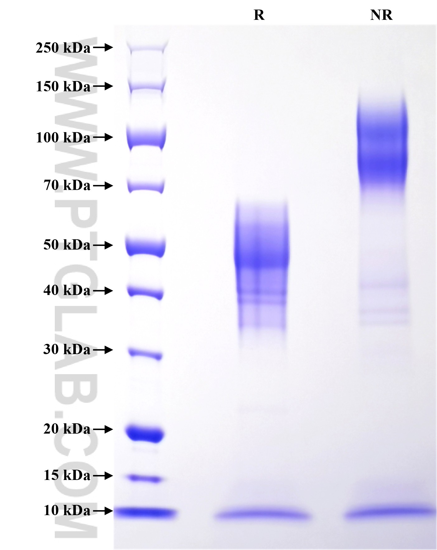 Purity of Recombinant Human Alpha Synuclein was determined by SDS-PAGE. The protein was resolved in an SDS-PAGE in reducing (R) and non-reducing (NR) conditions and stained using Coomassie blue.