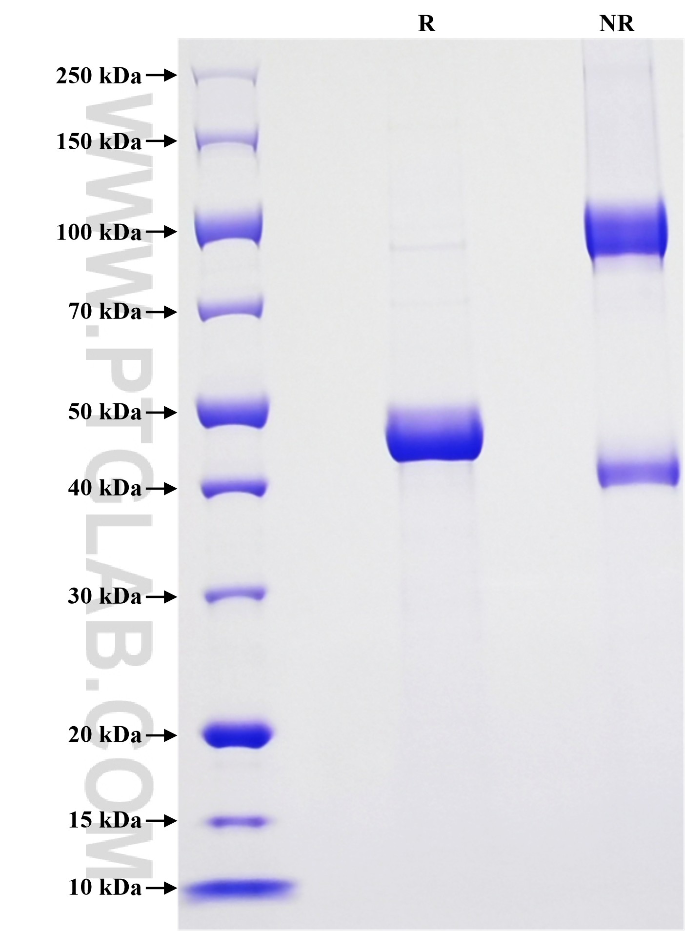 Purity of Recombinant Human CIB1 was determined by SDS-PAGE. The protein was resolved in an SDS-PAGE in reducing (R) and non-reducing (NR) conditions and stained using Coomassie blue.
