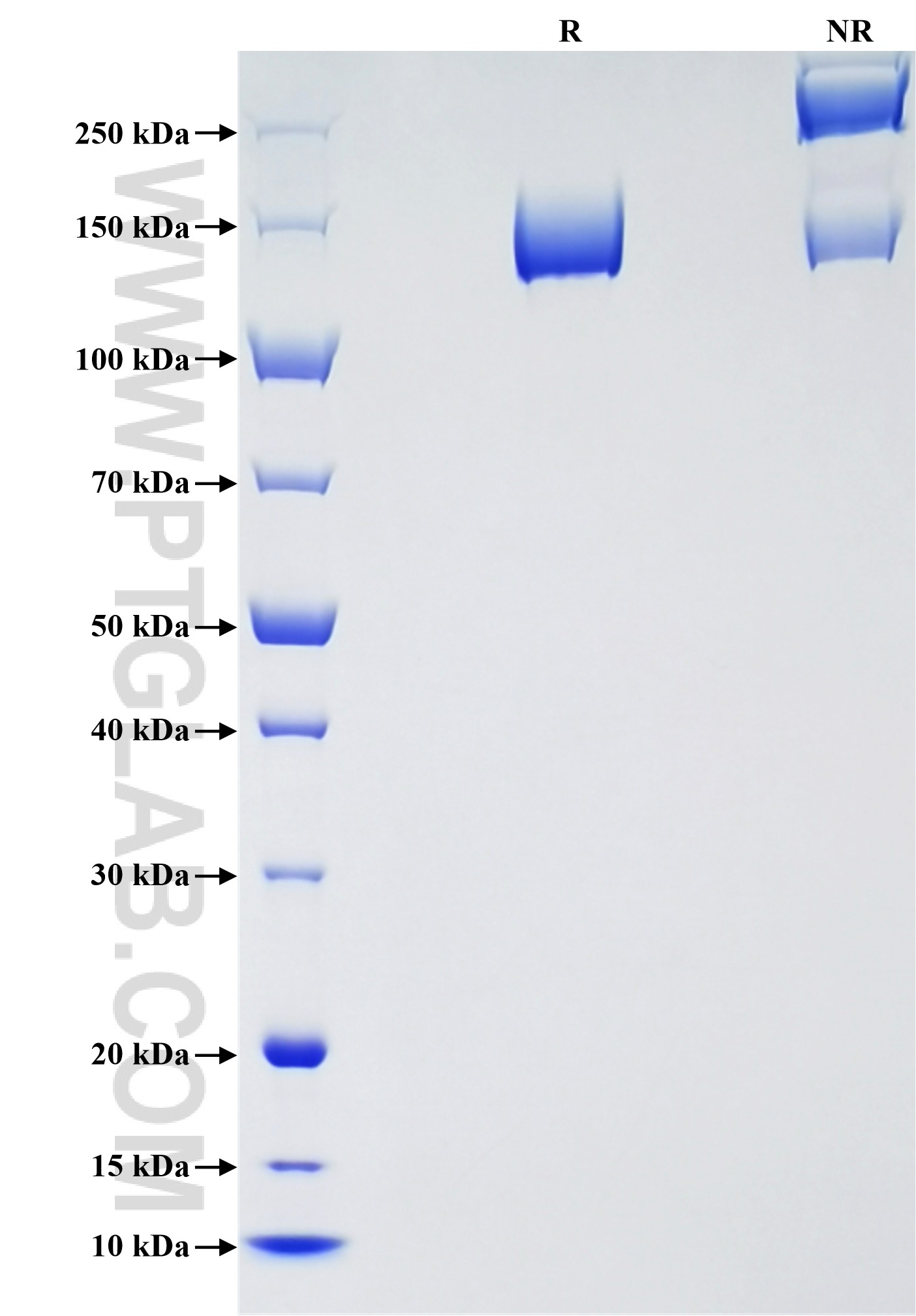 Purity of Recombinant Human CNTN2 was determined by SDS-PAGE. The protein was resolved in an SDS-PAGE in reducing (R) and non-reducing (NR) conditions and stained using Coomassie blue. Purity of Recombinant Human CNTN2 was determined by SDS-PAGE. The protein was resolved in an SDS-PAGE in reducing (R) and non-reducing (NR) conditions and stained using Coomassie blue.