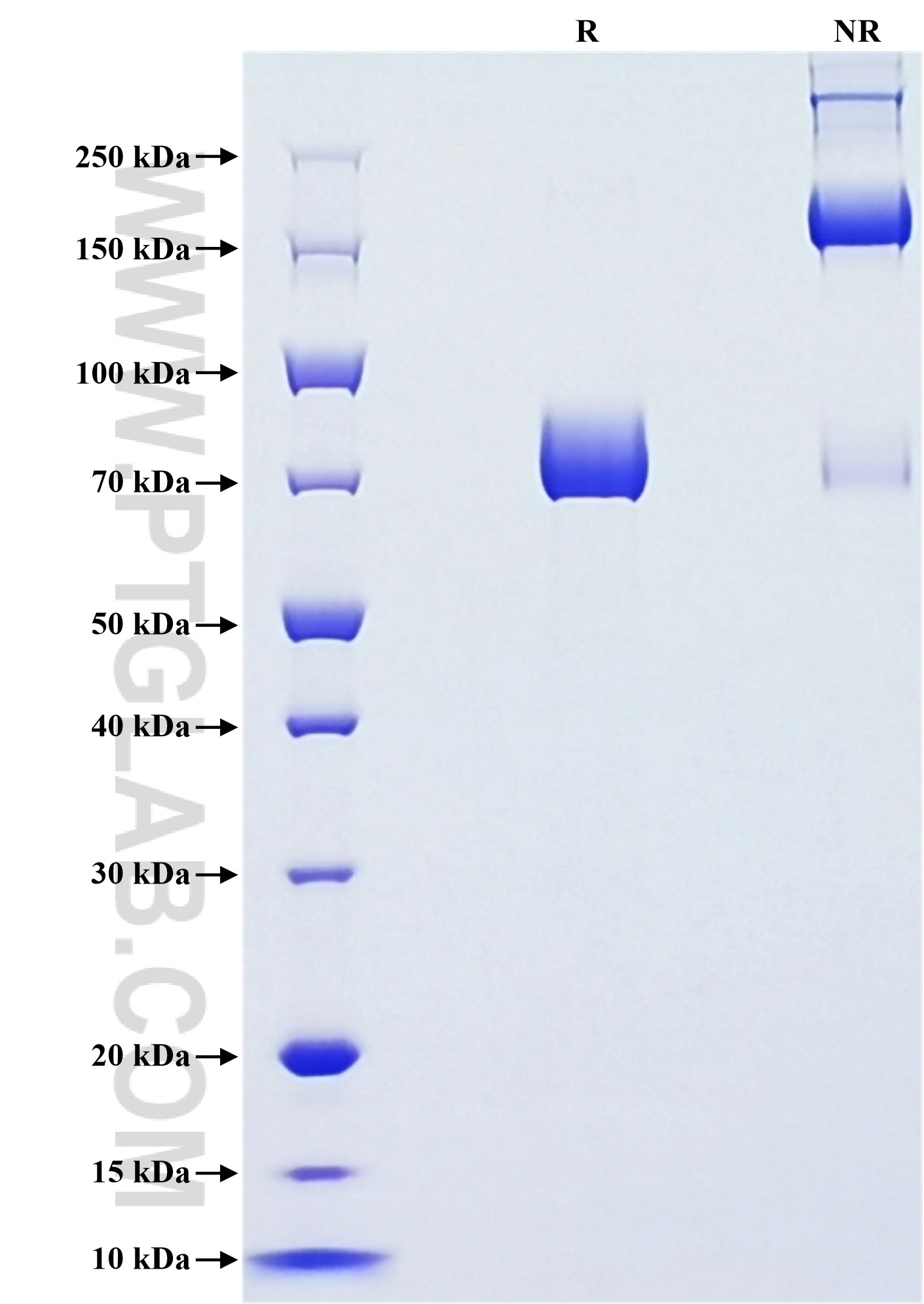 Purity of Recombinant Human DPEP1 was determined by SDS-PAGE. The protein was resolved in an SDS-PAGE in reducing (R) and non-reducing (NR) conditions and stained using Coomassie blue. Purity of Recombinant Human DPEP1 was determined by SDS-PAGE. The protein was resolved in an SDS-PAGE in reducing (R) and non-reducing (NR) conditions and stained using Coomassie blue.