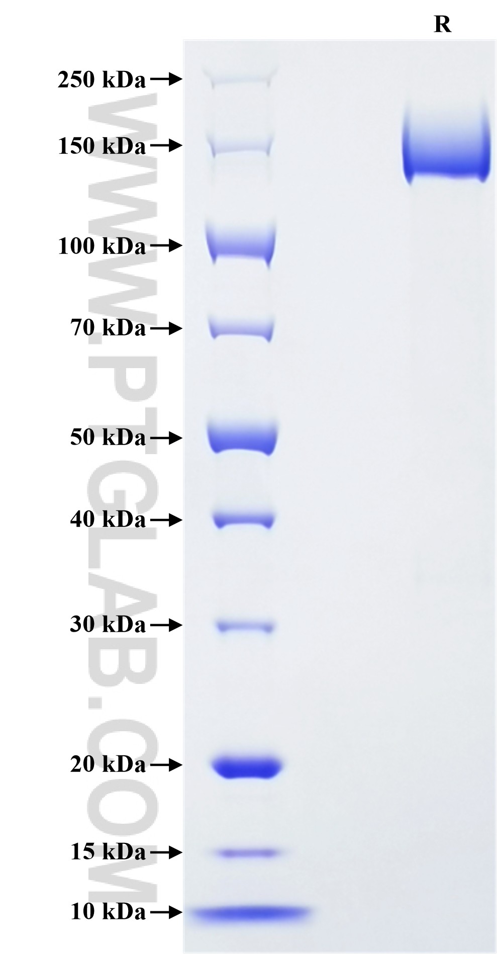 Purity of Recombinant Human Neogenin was determined by SDS-PAGE. The protein was resolved in an SDS-PAGE in reducing (R) conditions and stained using Coomassie blue. Purity of Recombinant Human Neogenin was determined by SDS-PAGE. The protein was resolved in an SDS-PAGE in reducing (R) conditions and stained using Coomassie blue.
