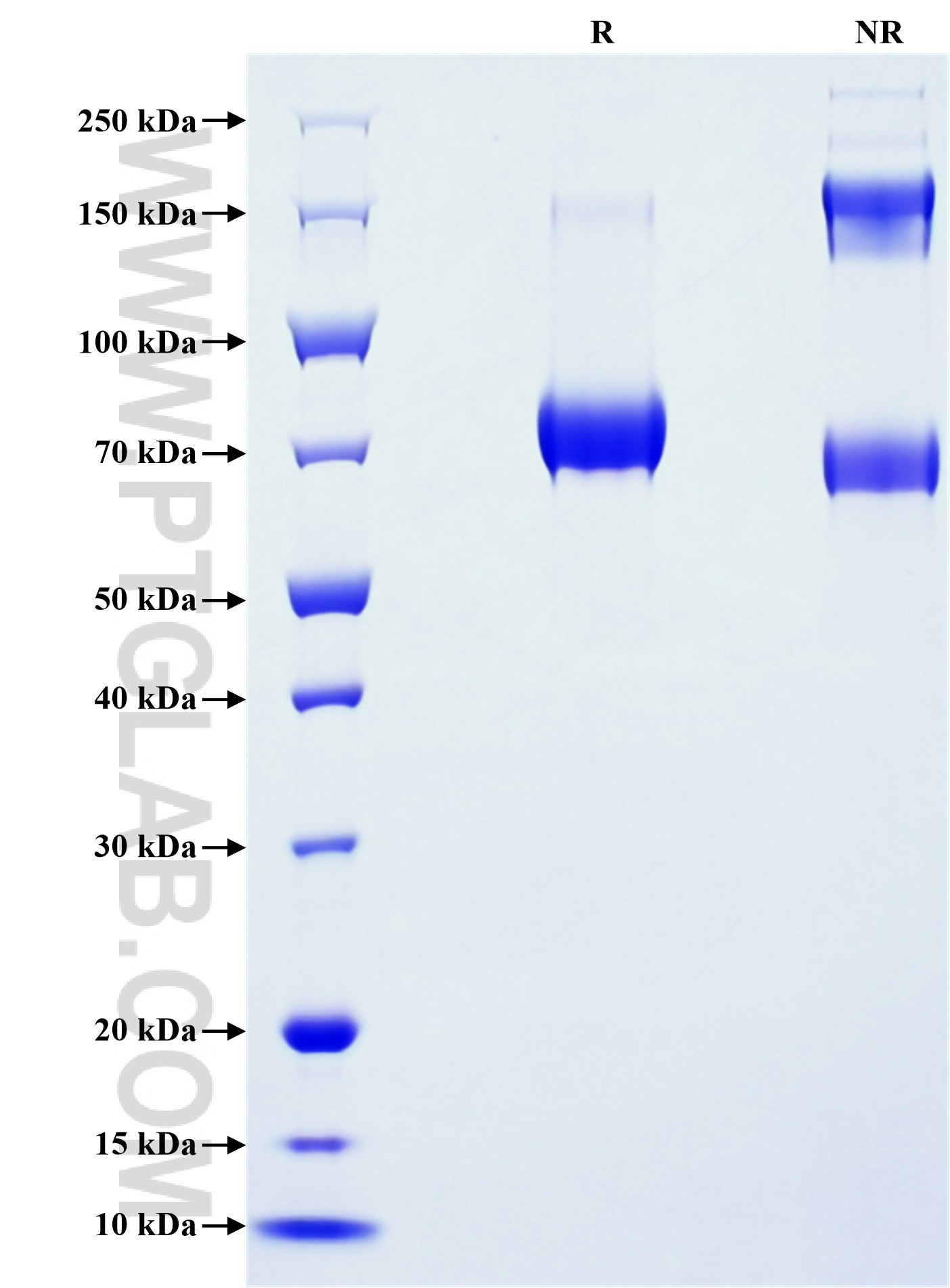 Purity of Recombinant Human NPTN was determined by SDS-PAGE. The protein was resolved in an SDS-PAGE in reducing (R) and non-reducing (NR) conditions and stained using Coomassie blue. Purity of Recombinant Human NPTN was determined by SDS-PAGE. The protein was resolved in an SDS-PAGE in reducing (R) and non-reducing (NR) conditions and stained using Coomassie blue.