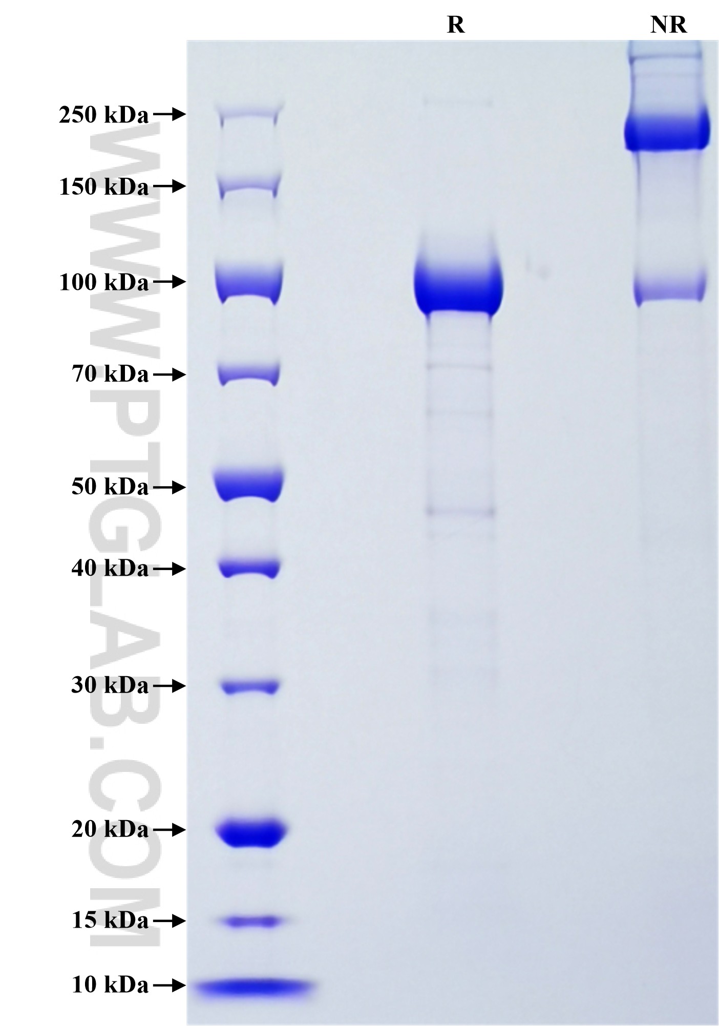 Purity of Recombinant Human Cadherin-13 was determined by SDS-PAGE. The protein was resolved in an SDS-PAGE in reducing (R) and non-reducing (NR) conditions and stained using Coomassie blue.
