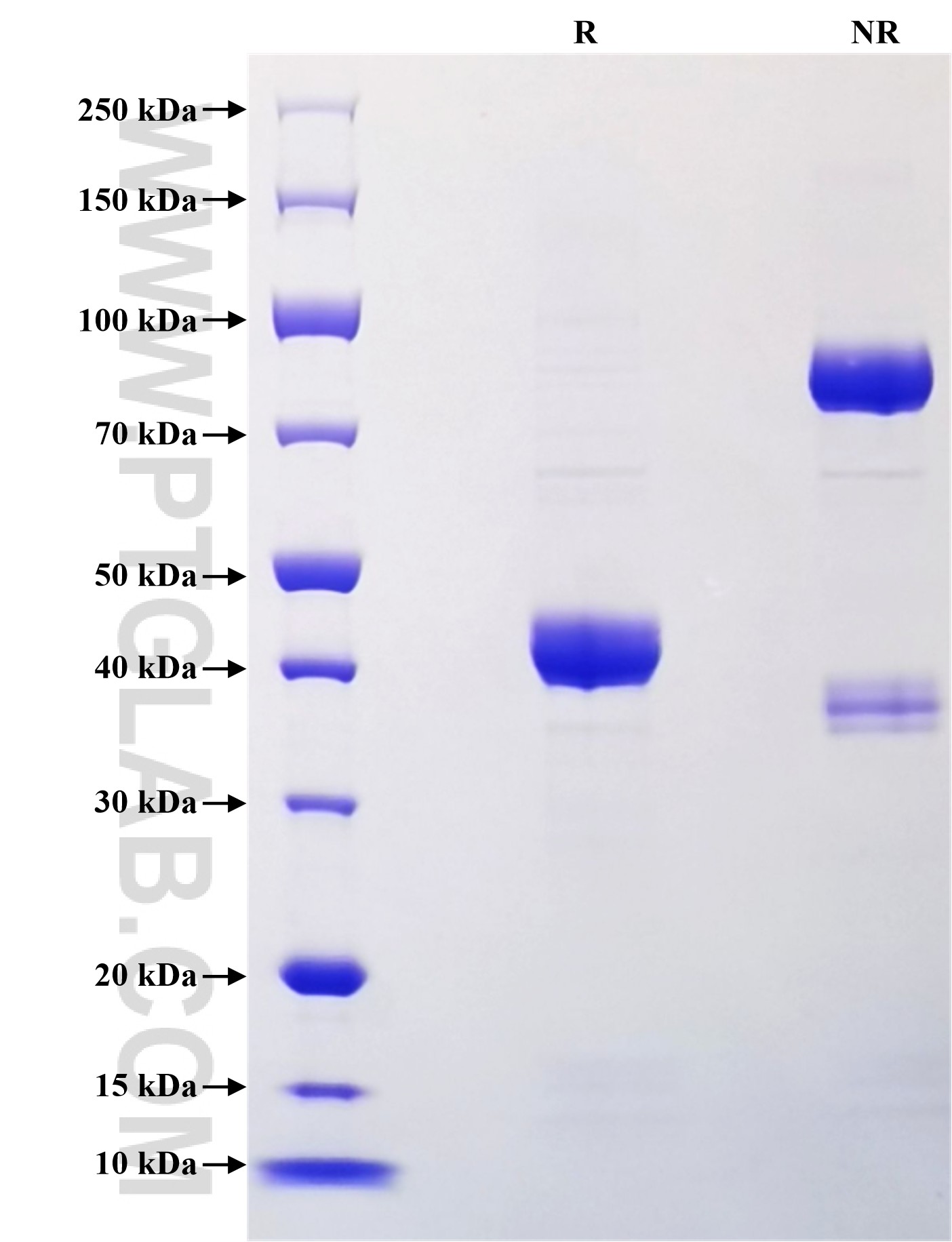Purity of Recombinant Human NRAC was determined by SDS-PAGE. The protein was resolved in an SDS-PAGE in reducing (R) and non-reducing (NR) conditions and stained using Coomassie blue. Purity of Recombinant Human NRAC was determined by SDS-PAGE. The protein was resolved in an SDS-PAGE in reducing (R) and non-reducing (NR) conditions and stained using Coomassie blue.