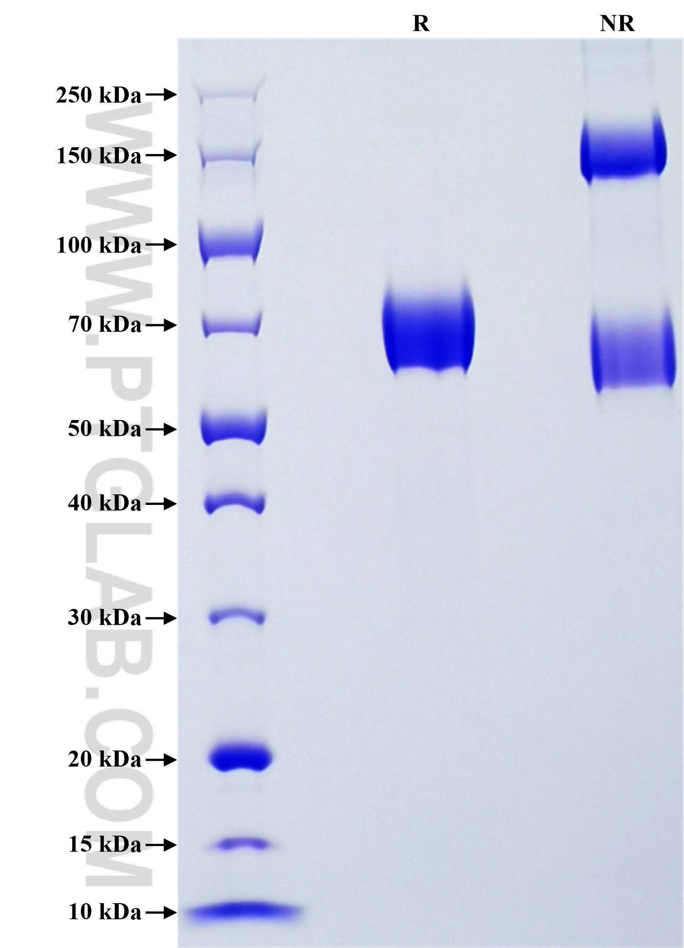 Purity of Recombinant Human MICB was determined by SDS-PAGE. The protein was resolved in an SDS-PAGE in reducing (R) and non-reducing (NR) conditions and stained using Coomassie blue. Purity of Recombinant Human MICB was determined by SDS-PAGE. The protein was resolved in an SDS-PAGE in reducing (R) and non-reducing (NR) conditions and stained using Coomassie blue.