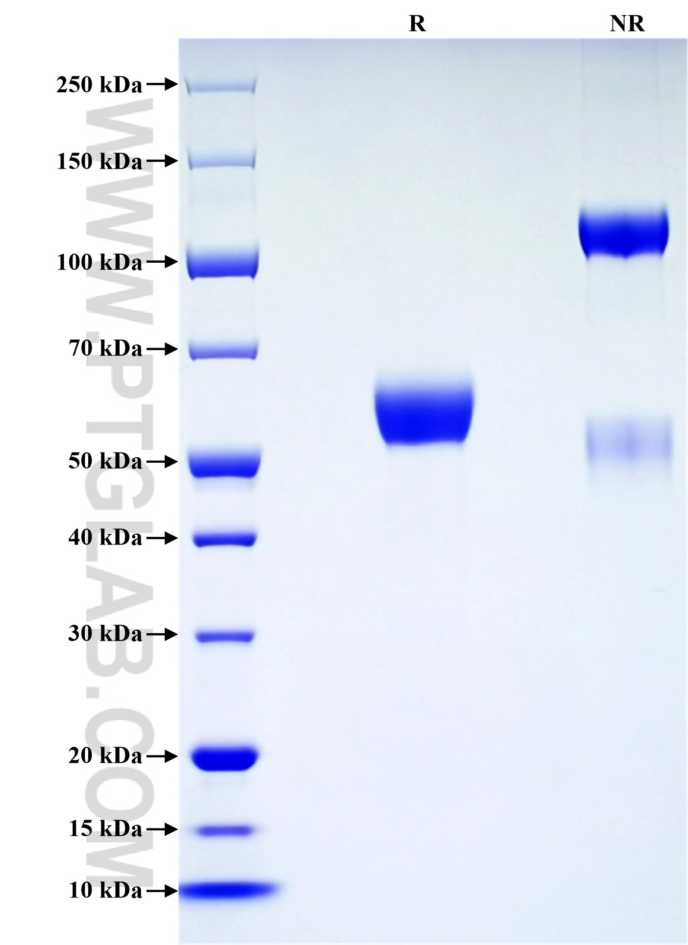 Purity of Recombinant Mouse LTBR was determined by SDS-PAGE. The protein was resolved in an SDS-PAGE in reducing (R) and non-reducing (NR) conditions and stained using Coomassie blue. Purity of Recombinant Mouse LTBR was determined by SDS-PAGE. The protein was resolved in an SDS-PAGE in reducing (R) and non-reducing (NR) conditions and stained using Coomassie blue.