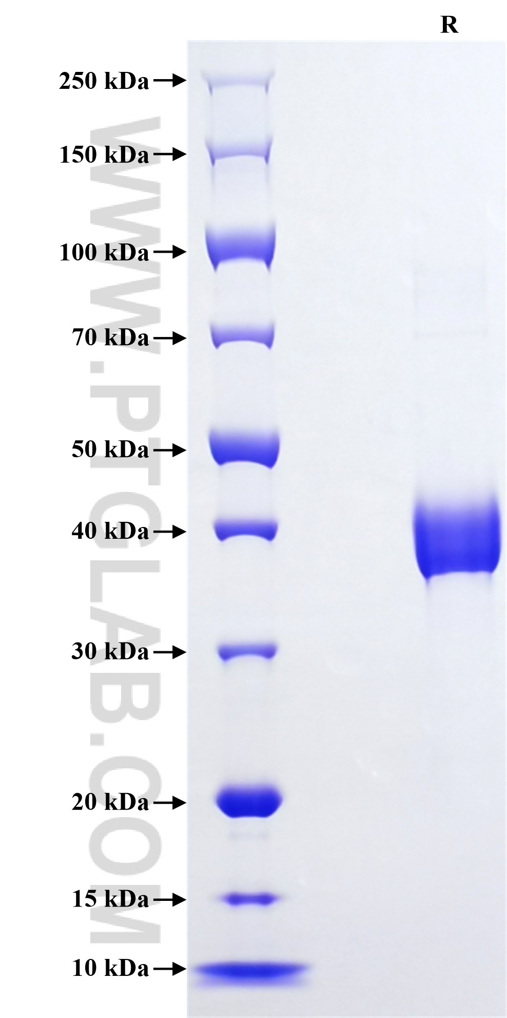 Purity of Recombinant Mouse TGF-alpha was determined by SDS-PAGE. The protein was resolved in an SDS-PAGE in reducing (R) conditions and stained using Coomassie blue. Purity of Recombinant Mouse TGF-alpha was determined by SDS-PAGE. The protein was resolved in an SDS-PAGE in reducing (R) conditions and stained using Coomassie blue.