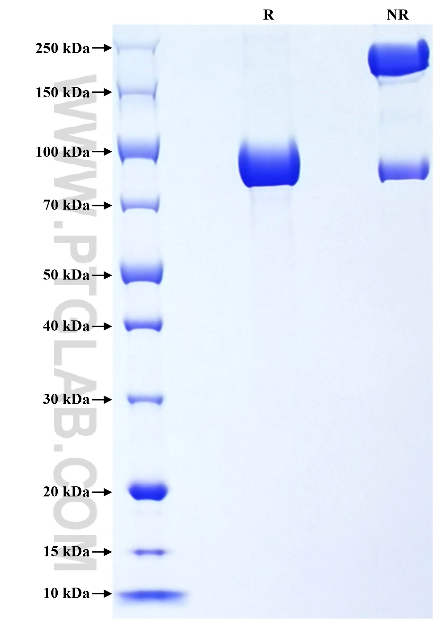 Purity of Recombinant Mouse IGSF8 was determined by SDS-PAGE. The protein was resolved in an SDS-PAGE in reducing (R) and non-reducing (NR) conditions and stained using Coomassie blue. Purity of Recombinant Mouse IGSF8 was determined by SDS-PAGE. The protein was resolved in an SDS-PAGE in reducing (R) and non-reducing (NR) conditions and stained using Coomassie blue.
