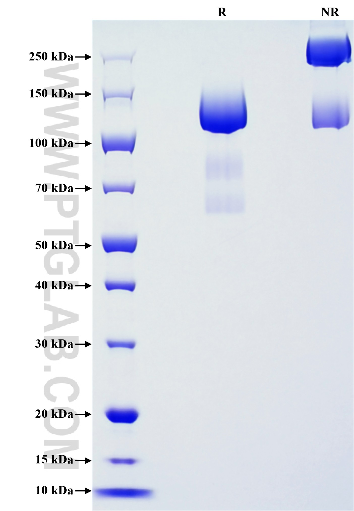 Purity of Recombinant Mouse VEGFR3 was determined by SDS-PAGE. The protein was resolved in an SDS-PAGE in reducing (R) and non-reducing (NR) conditions and stained using Coomassie blue. Purity of Recombinant Mouse VEGFR3 was determined by SDS-PAGE. The protein was resolved in an SDS-PAGE in reducing (R) and non-reducing (NR) conditions and stained using Coomassie blue.