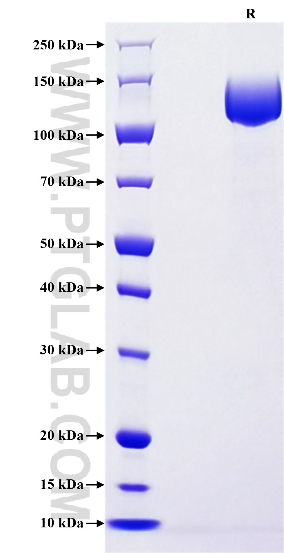 Purity of Recombinant Human MUC16 was determined by SDS-PAGE. The protein was resolved in an SDS-PAGE in reducing (R) conditions and stained using Coomassie blue. Purity of Recombinant Human MUC16 was determined by SDS-PAGE. The protein was resolved in an SDS-PAGE in reducing (R) conditions and stained using Coomassie blue.