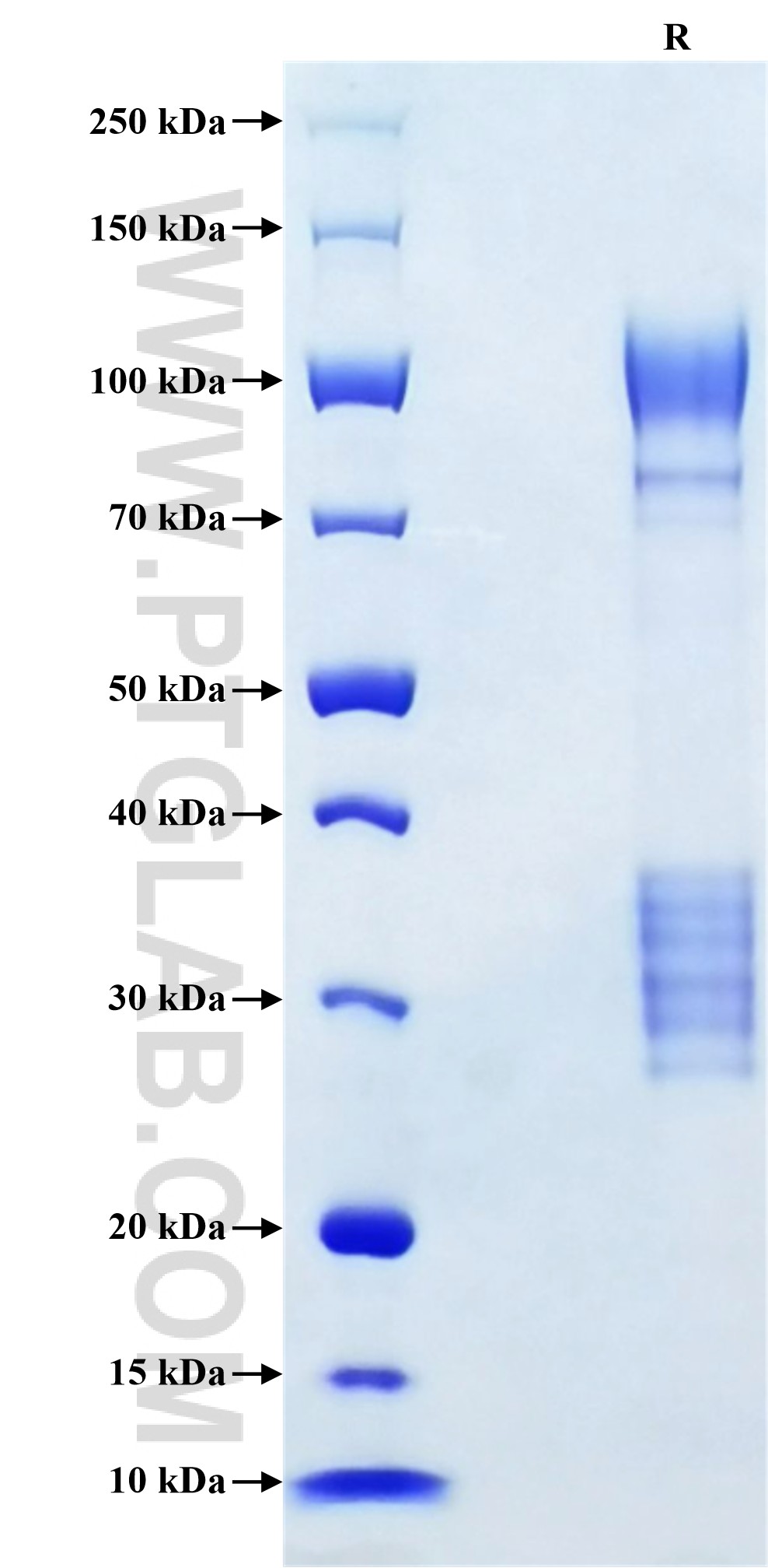 Purity of Recombinant Human WWTR1 was determined by SDS-PAGE. The protein was resolved in an SDS-PAGE in reducing (R) conditions and stained using Coomassie blue. Purity of Recombinant Human WWTR1 was determined by SDS-PAGE. The protein was resolved in an SDS-PAGE in reducing (R) conditions and stained using Coomassie blue.