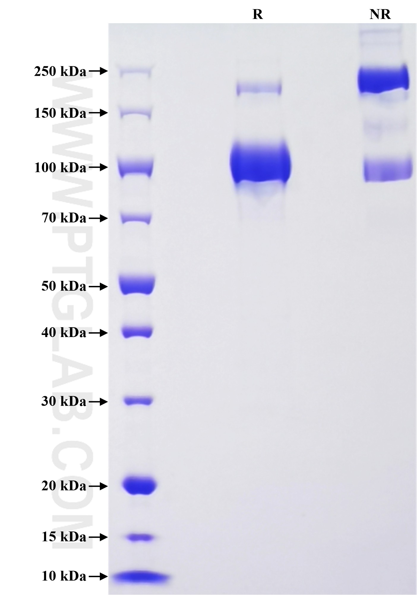 Purity of Recombinant Human PIGR was determined by SDS-PAGE. The protein was resolved in an SDS-PAGE in reducing (R) and non-reducing (NR) conditions and stained using Coomassie blue.