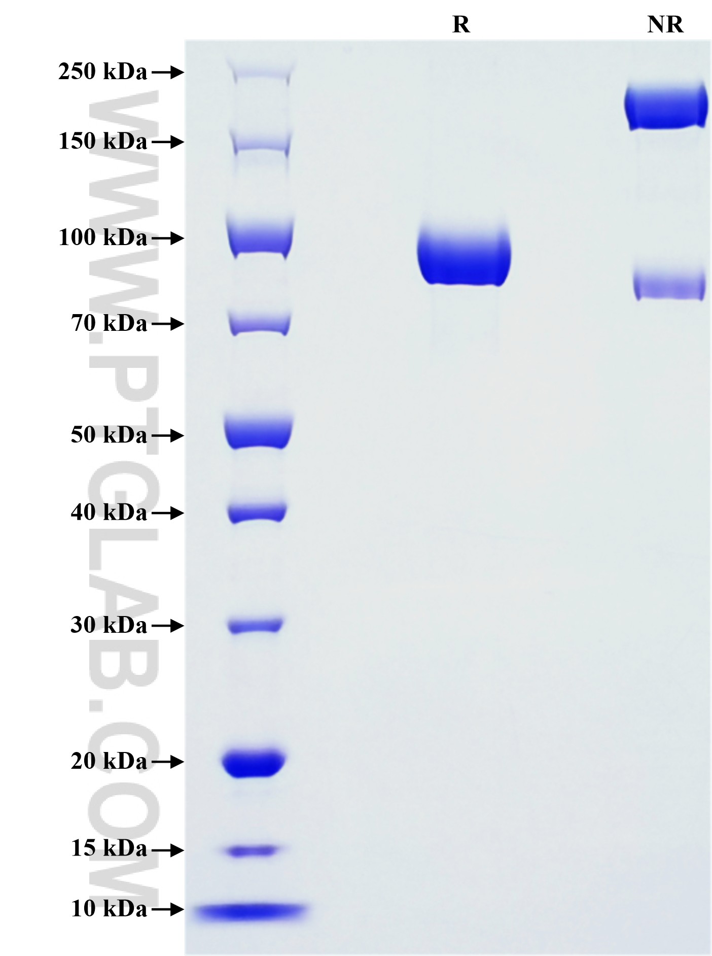 Purity of Recombinant Human EPHB4 was determined by SDS-PAGE. The protein was resolved in an SDS-PAGE in reducing (R) and non-reducing (NR) conditions and stained using Coomassie blue.