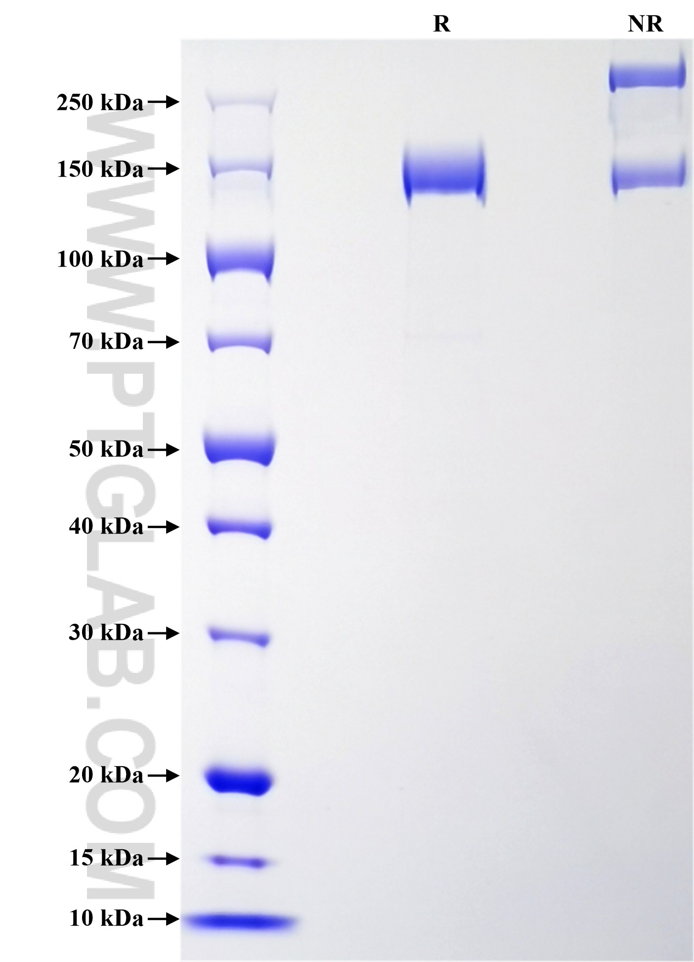 Purity of Recombinant Human CNTN1 was determined by SDS-PAGE. The protein was resolved in an SDS-PAGE in reducing (R) and non-reducing (NR) conditions and stained using Coomassie blue. Purity of Recombinant Human CNTN1 was determined by SDS-PAGE. The protein was resolved in an SDS-PAGE in reducing (R) and non-reducing (NR) conditions and stained using Coomassie blue.
