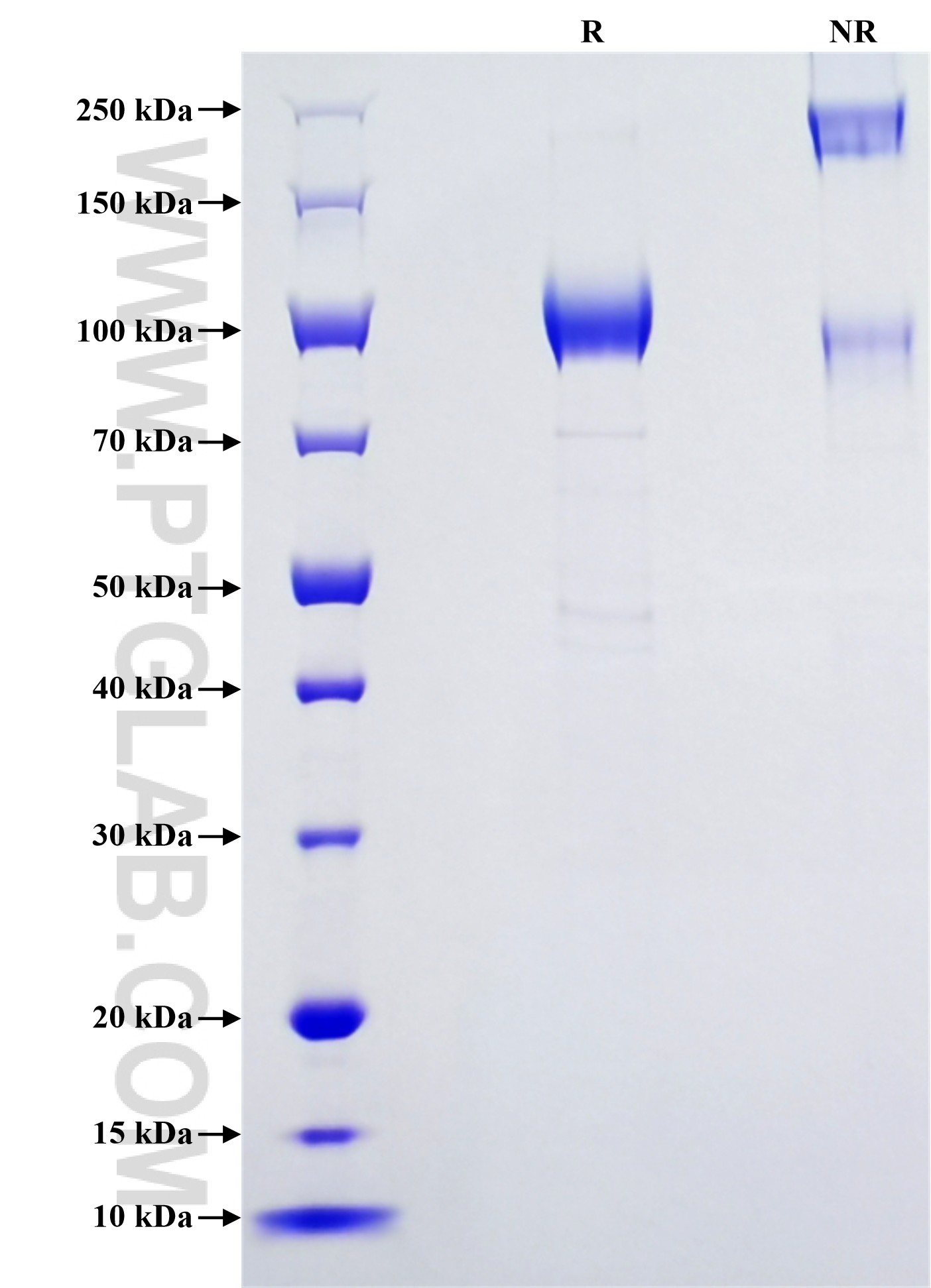 Purity of Recombinant Human Cubilin was determined by SDS-PAGE. The protein was resolved in an SDS-PAGE in reducing (R) and non-reducing (NR) conditions and stained using Coomassie blue. Purity of Recombinant Human Cubilin was determined by SDS-PAGE. The protein was resolved in an SDS-PAGE in reducing (R) and non-reducing (NR) conditions and stained using Coomassie blue.