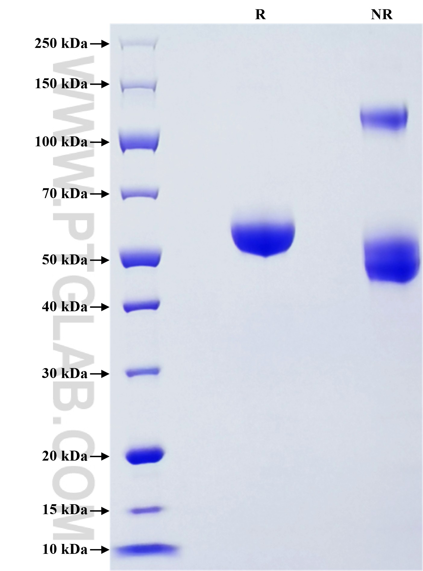Purity of Recombinant Human JAM3 was determined by SDS-PAGE. The protein was resolved in an SDS-PAGE in reducing (R) and non-reducing (NR) conditions and stained using Coomassie blue.