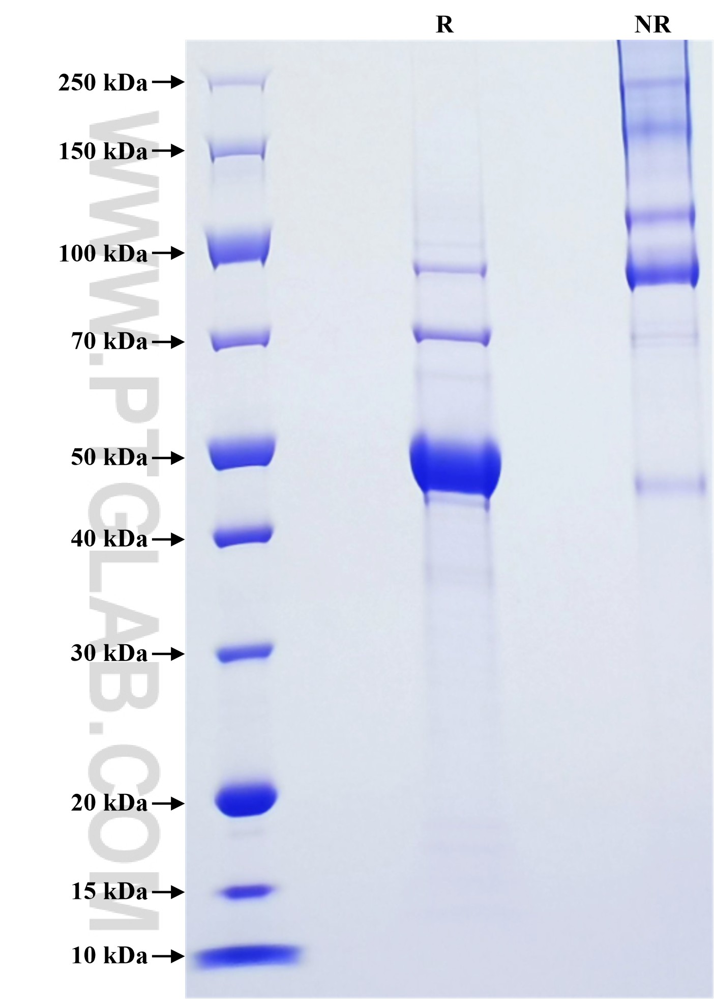Purity of Recombinant Human RRAS was determined by SDS-PAGE. The protein was resolved in an SDS-PAGE in reducing (R) conditions and stained using Coomassie blue. Purity of Recombinant Human RRAS was determined by SDS-PAGE. The protein was resolved in an SDS-PAGE in reducing (R) conditions and stained using Coomassie blue.