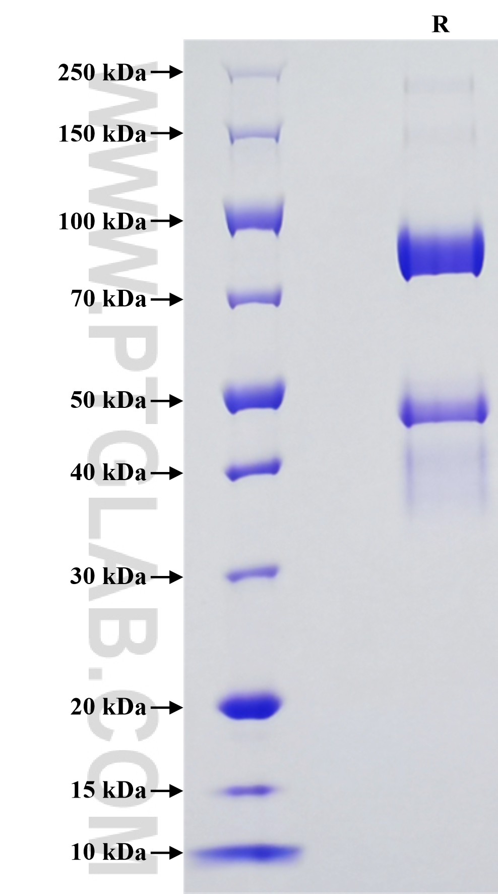 Purity of Recombinant Human HP was determined by SDS-PAGE. The protein was resolved in an SDS-PAGE in reducing (R) conditions and stained using Coomassie blue.