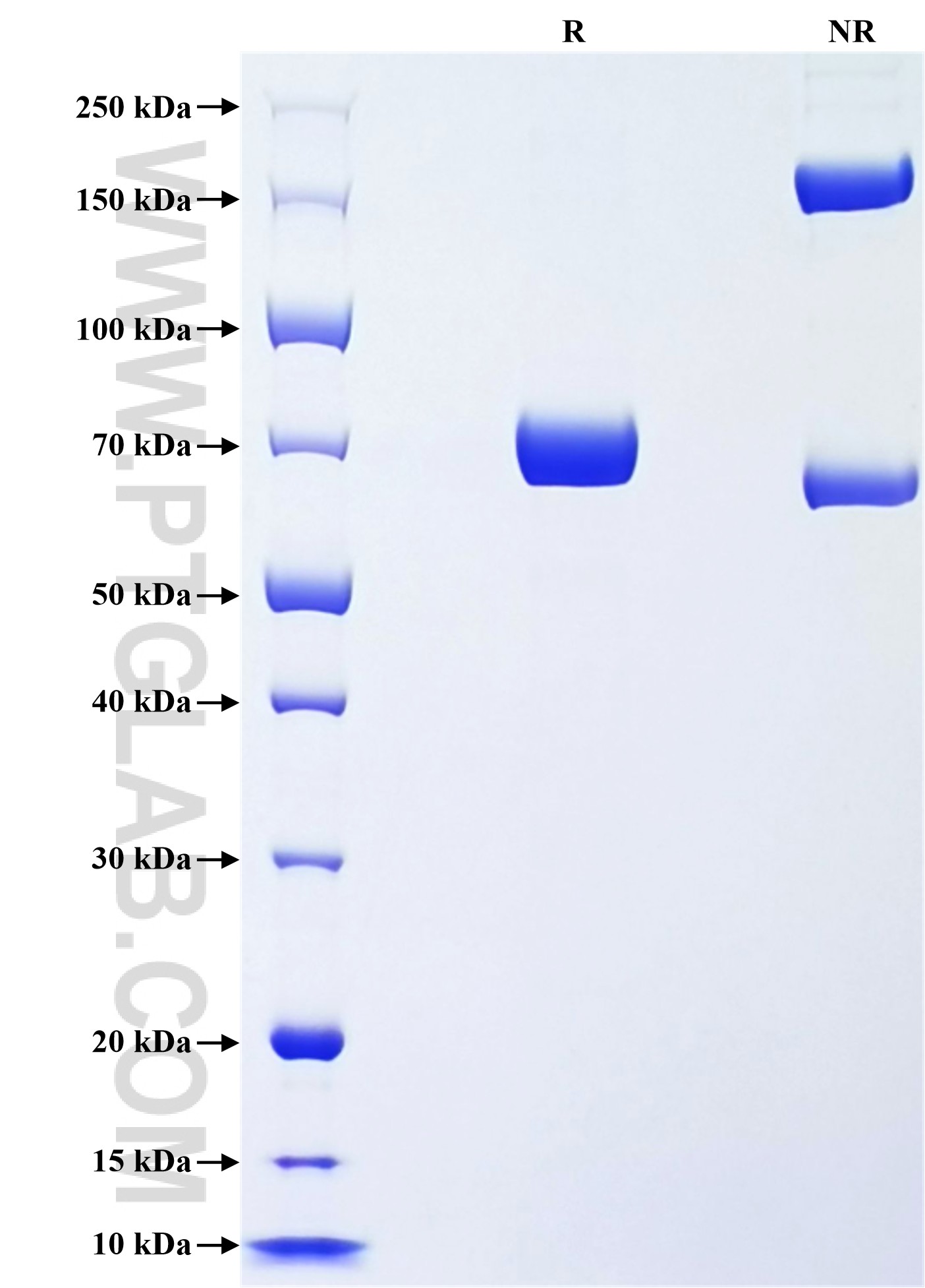 Purity of Recombinant Human POFUT1 was determined by SDS-PAGE. The protein was resolved in an SDS-PAGE in reducing (R) and non-reducing (NR) conditions and stained using Coomassie blue. Purity of Recombinant Human POFUT1 was determined by SDS-PAGE. The protein was resolved in an SDS-PAGE in reducing (R) and non-reducing (NR) conditions and stained using Coomassie blue.