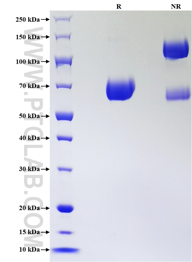 Purity of Recombinant Human Zinc Alpha 2 Glycoprotein was determined by SDS-PAGE. The protein was resolved in an SDS-PAGE in reducing (R) and non-reducing (NR) conditions and stained using Coomassie blue.