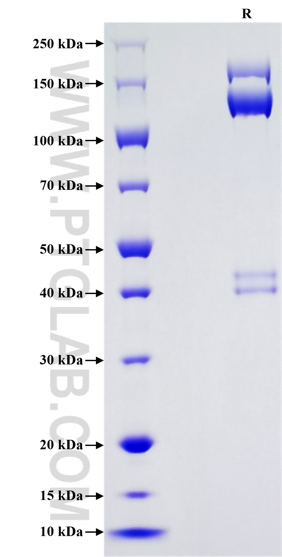 Purity of Recombinant Human PTPRF was determined by SDS-PAGE. The protein was resolved in an SDS-PAGE in reducing (R) conditions and stained using Coomassie blue. Purity of Recombinant Human PTPRF was determined by SDS-PAGE. The protein was resolved in an SDS-PAGE in reducing (R) conditions and stained using Coomassie blue.