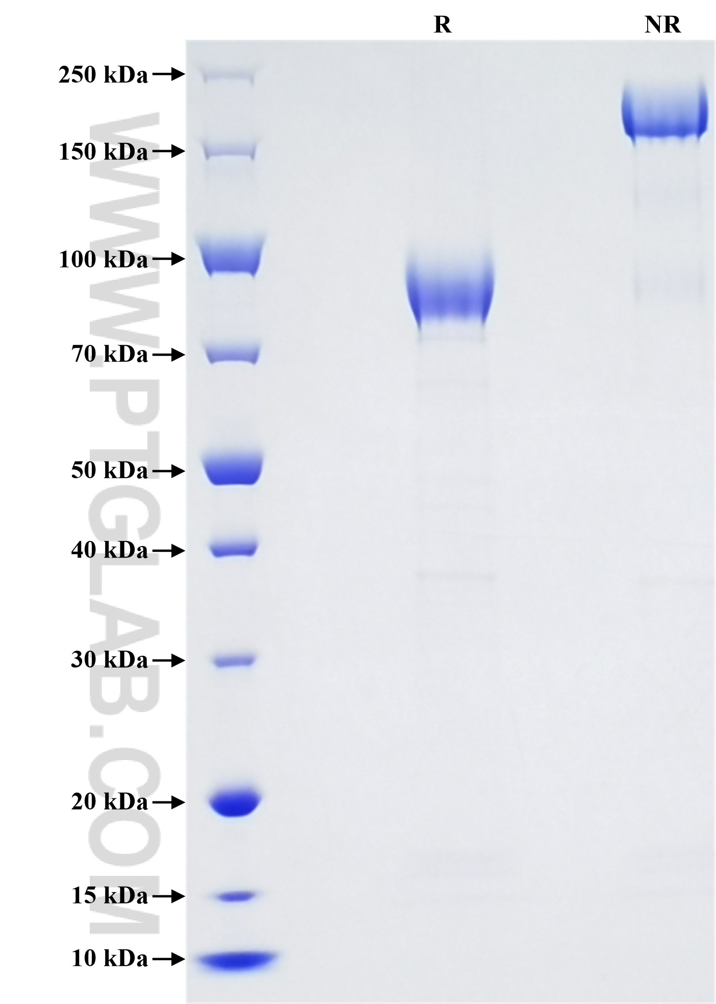 Purity of Recombinant Mouse TREML2 was determined by SDS-PAGE. The protein was resolved in an SDS-PAGE in reducing (R) and non-reducing (NR) conditions and stained using Coomassie blue. Purity of Recombinant Mouse TREML2 was determined by SDS-PAGE. The protein was resolved in an SDS-PAGE in reducing (R) and non-reducing (NR) conditions and stained using Coomassie blue.