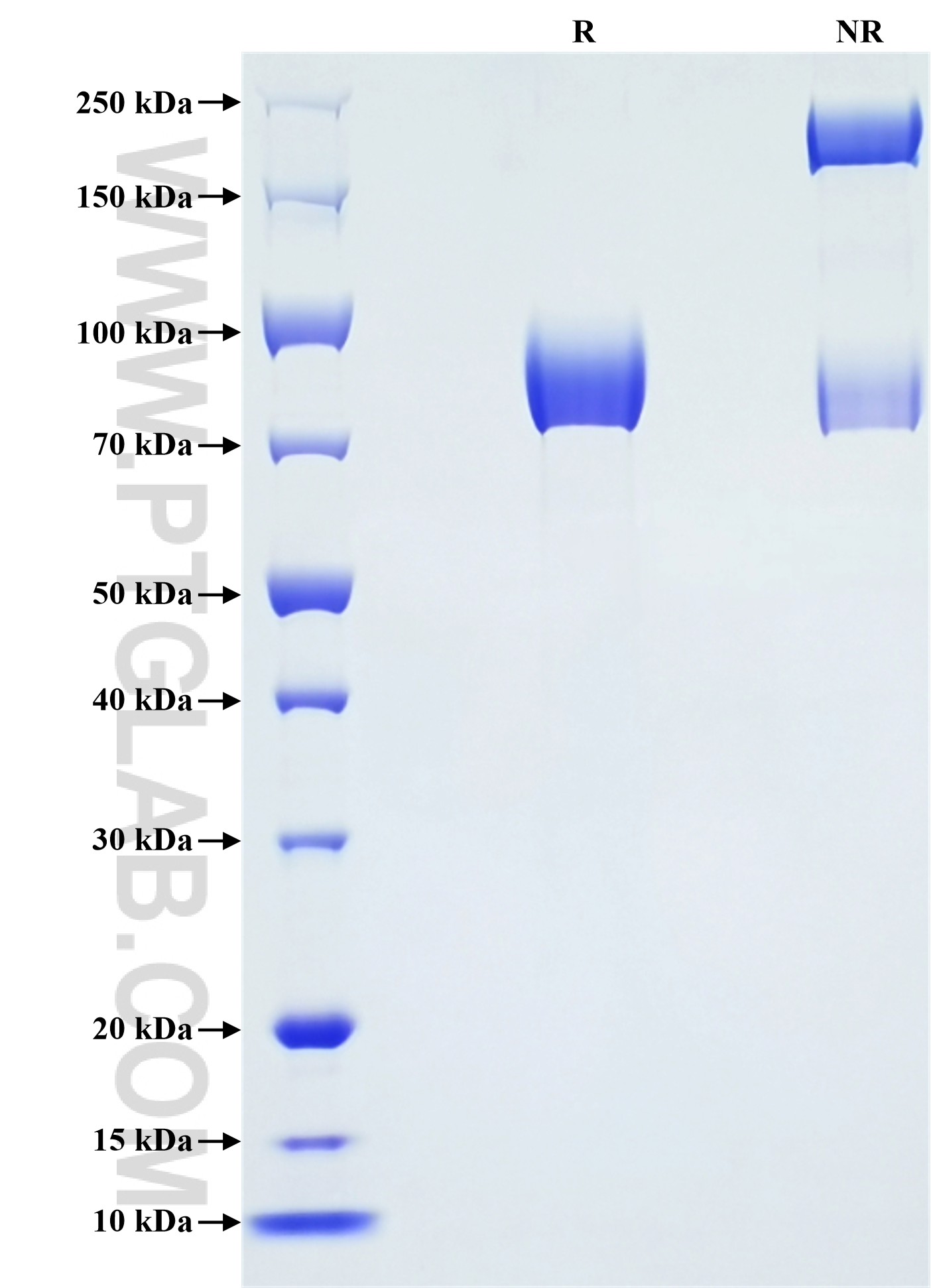 Purity of Recombinant Human ROBO4 was determined by SDS-PAGE. The protein was resolved in an SDS-PAGE in reducing (R) and non-reducing (NR) conditions and stained using Coomassie blue. Purity of Recombinant Human ROBO4 was determined by SDS-PAGE. The protein was resolved in an SDS-PAGE in reducing (R) and non-reducing (NR) conditions and stained using Coomassie blue.