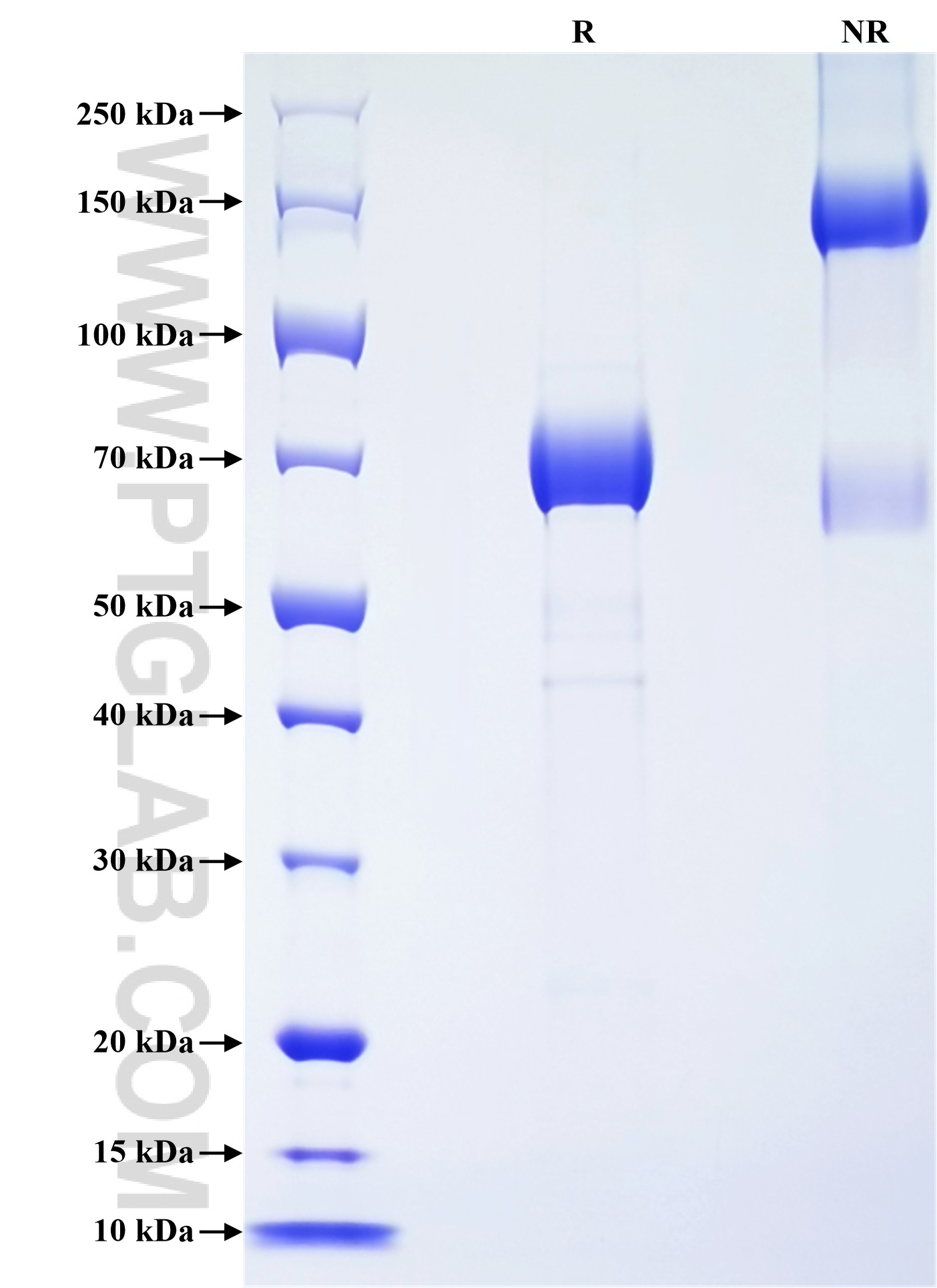 Purity of Recombinant Human PSG2 was determined by SDS-PAGE. The protein was resolved in an SDS-PAGE in reducing (R) and non-reducing (NR) conditions and stained using Coomassie blue. Purity of Recombinant Human PSG2 was determined by SDS-PAGE. The protein was resolved in an SDS-PAGE in reducing (R) and non-reducing (NR) conditions and stained using Coomassie blue.