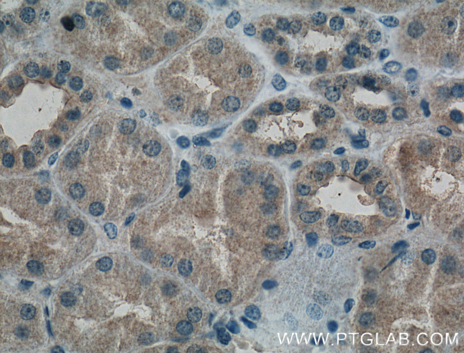 IHC staining of human kidney using 66261-1-Ig