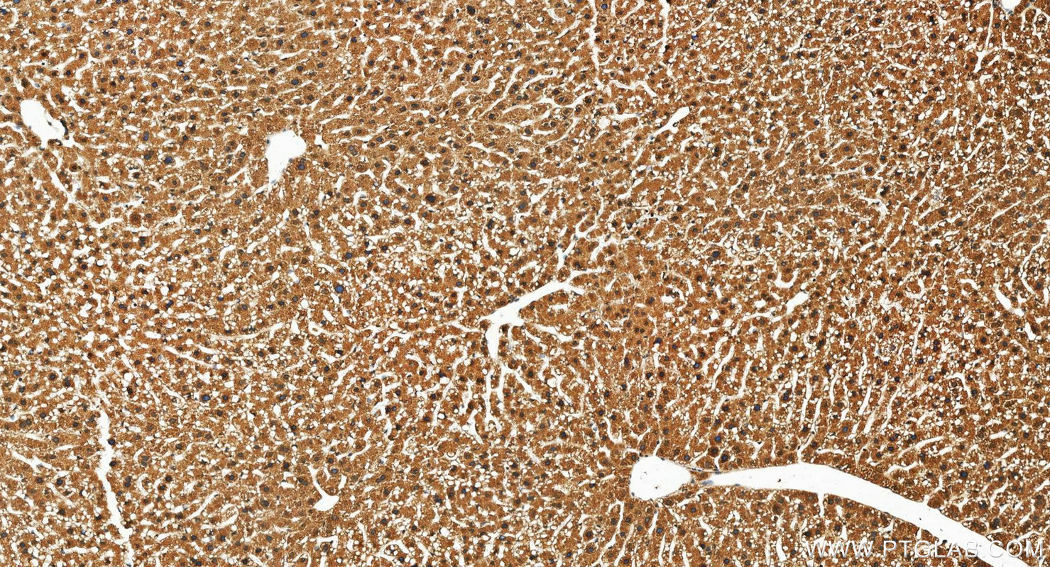 IHC staining of mouse liver using 12967-1-AP IHC staining of mouse liver using 12967-1-AP