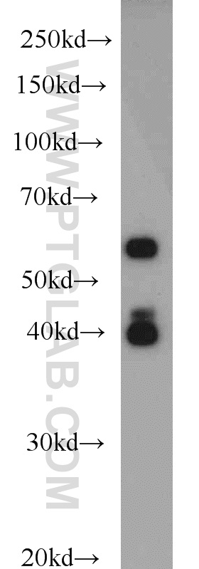 WB analysis of HeLa using 10675-1-AP