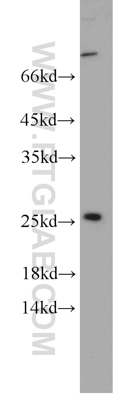 WB analysis of A431 using 15583-1-AP