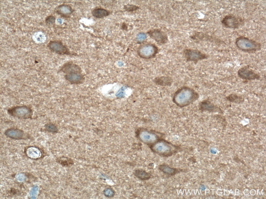 IHC staining of mouse brain using 21401-1-AP