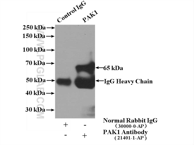 IP experiment of K-562 using 21401-1-AP