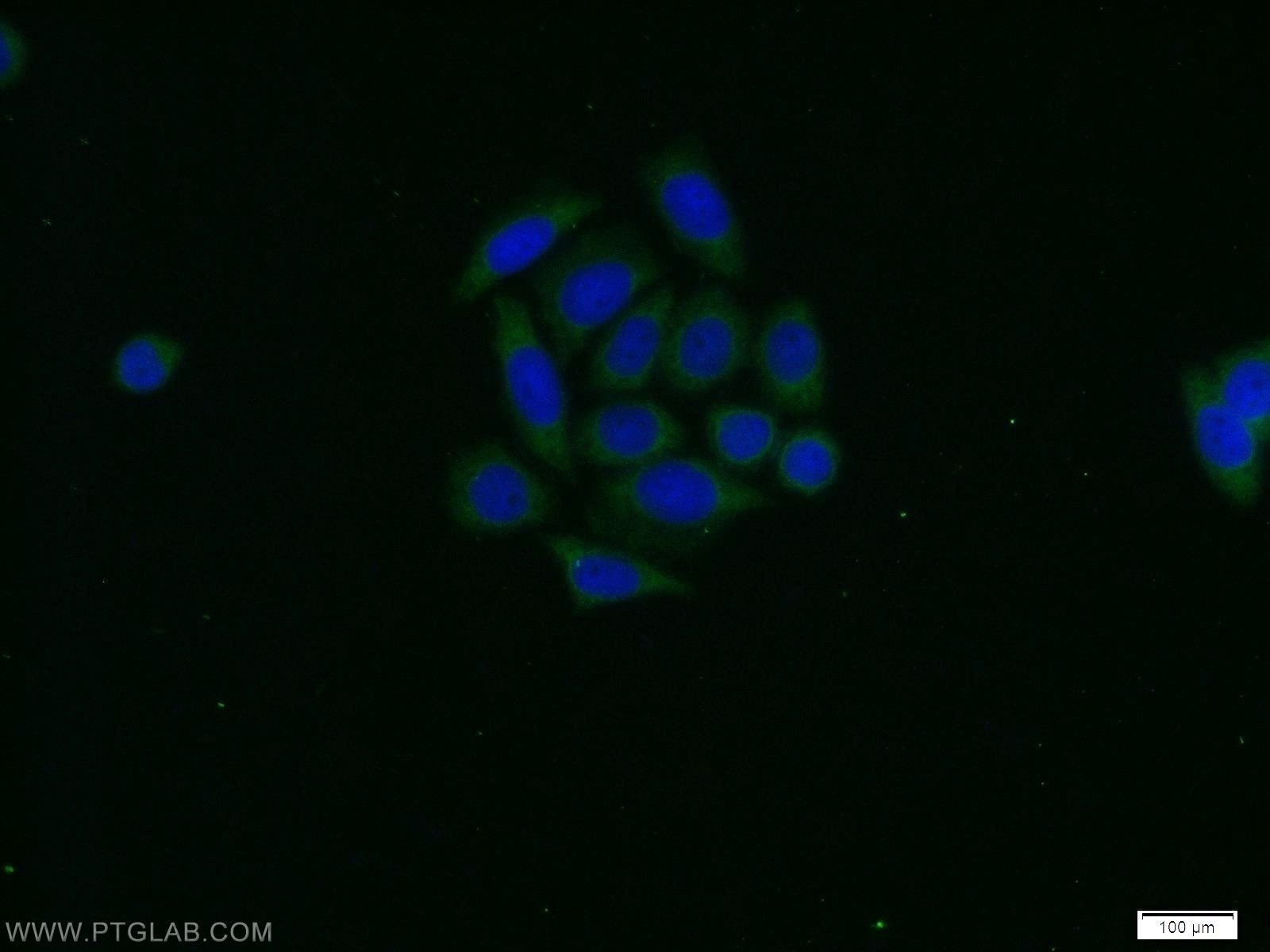 IF Staining of HeLa using 51137-1-AP